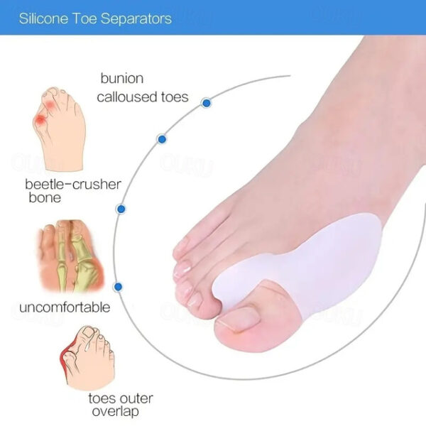 Bunion Cushion Protection (Suitable Night And Home Use And Replace Them Regularly) Toe Corrector Relieving Pressure For Pain Relief 2025 - US $12.49