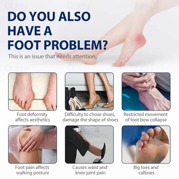 Bunion Cushion Protection (Suitable Night And Home Use And Replace Them Regularly) Toe Corrector Relieving Pressure For Pain Relief 2025 - US $12.49