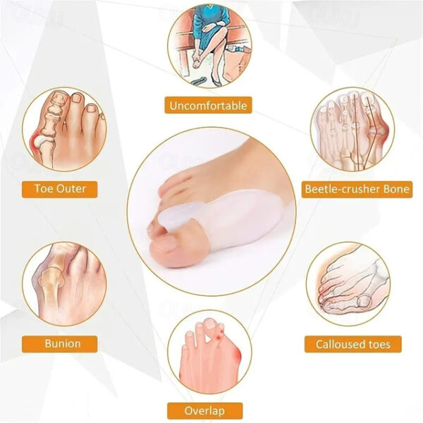 Bunion Cushion Protection (Suitable Night And Home Use And Replace Them Regularly) Toe Corrector Relieving Pressure For Pain Relief 2025 - US $12.49