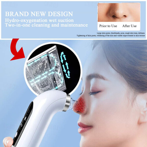 Electric Purple Light Therapy Small Bubble Water Cycle Blackhead Remover Pore Acne Pimple Removal Vacuum Suction Facial Cleaner Tool 2025 - US $24.99