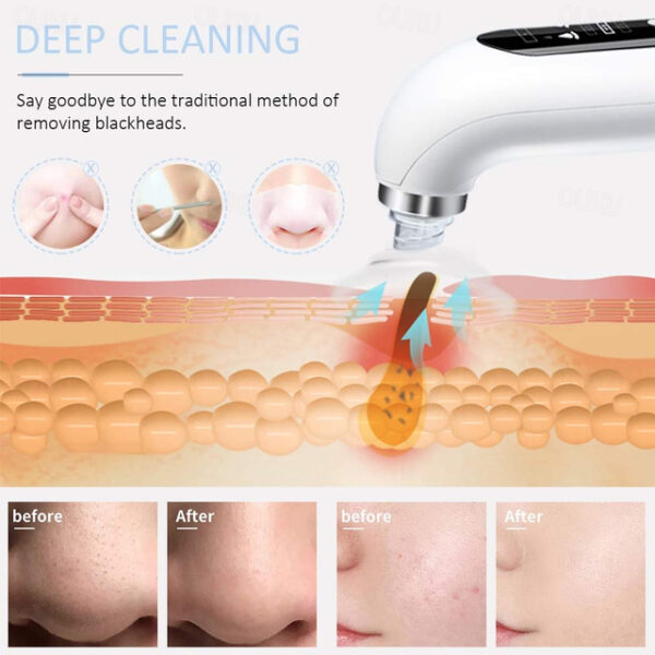 Electric Purple Light Therapy Small Bubble Water Cycle Blackhead Remover Pore Acne Pimple Removal Vacuum Suction Facial Cleaner Tool 2025 - US $24.99