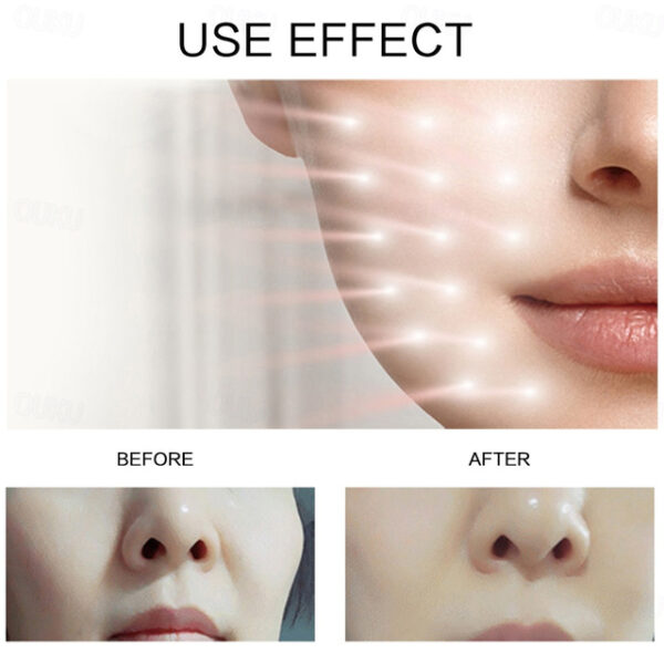 Wireless 7 Colors LED Light Therapy Face Mask Photon Therapy Mask For Skin Rejuvenation Anti Aging Wrinkle Freckle Removal Acne Treatment 2025 - US $8